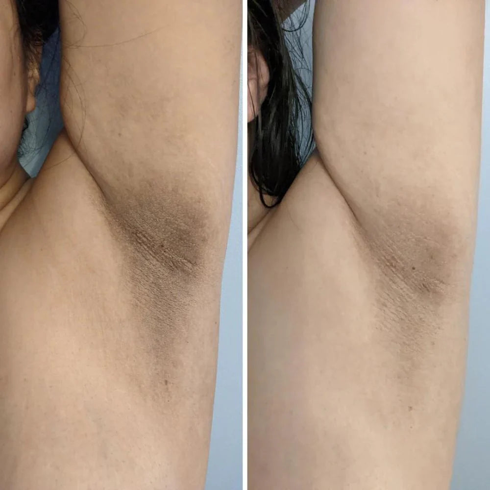 Bermuda Dark Spot Oil