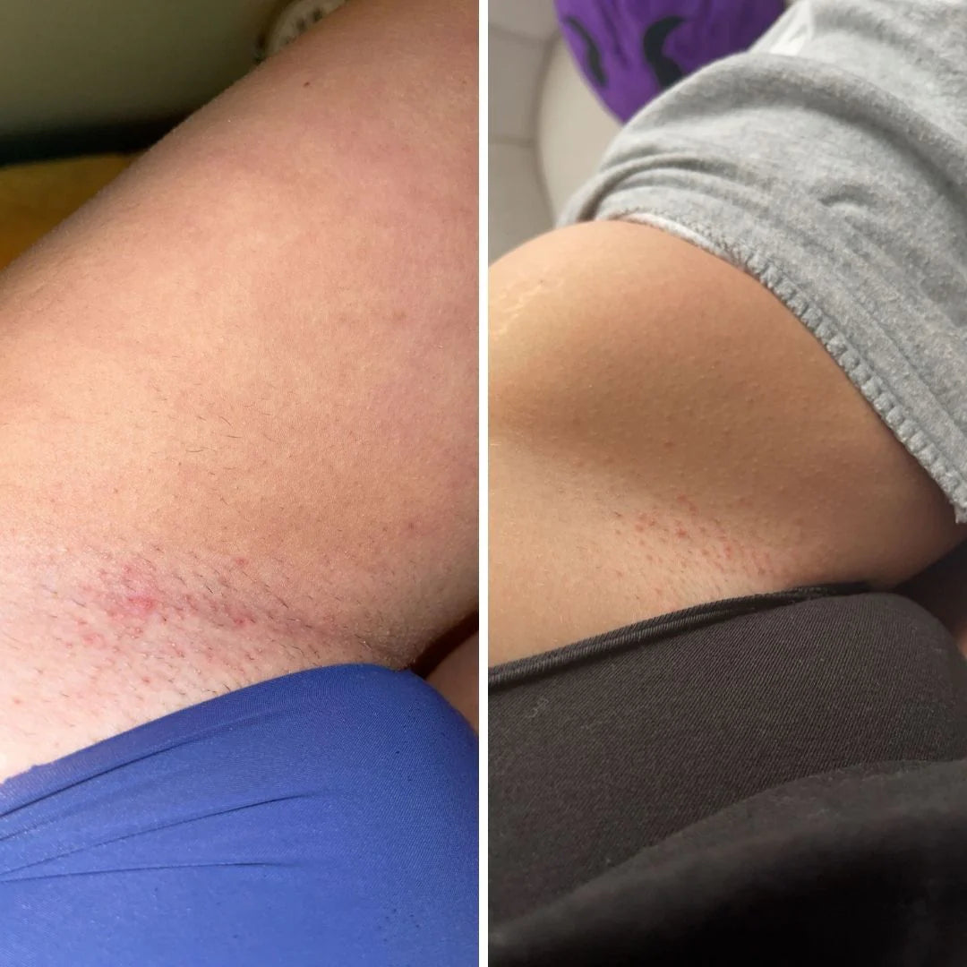 Nude Ingrown Hair Exfoliating Scrub