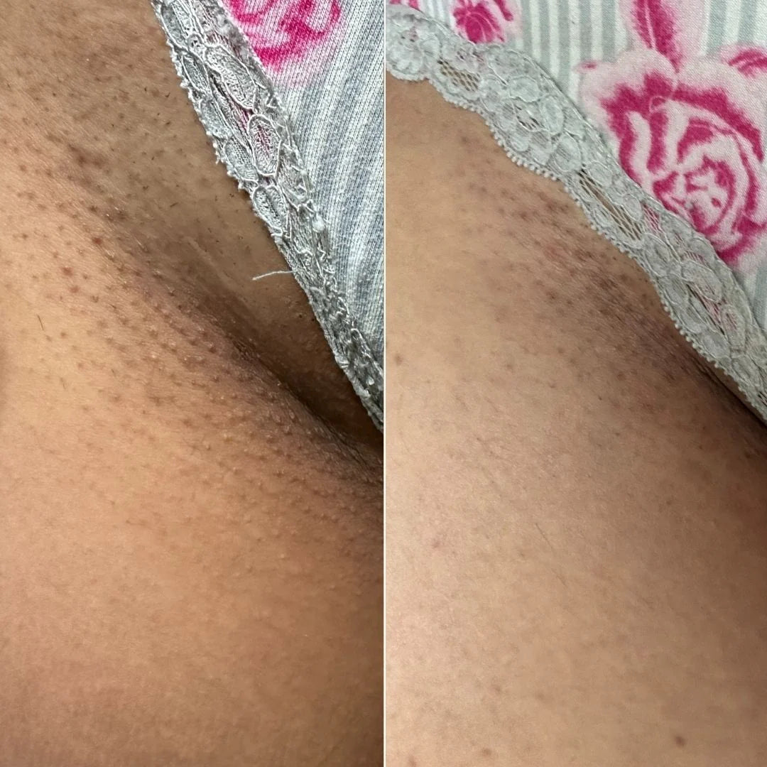 Radiant Reset Exfoliating Toner Pads